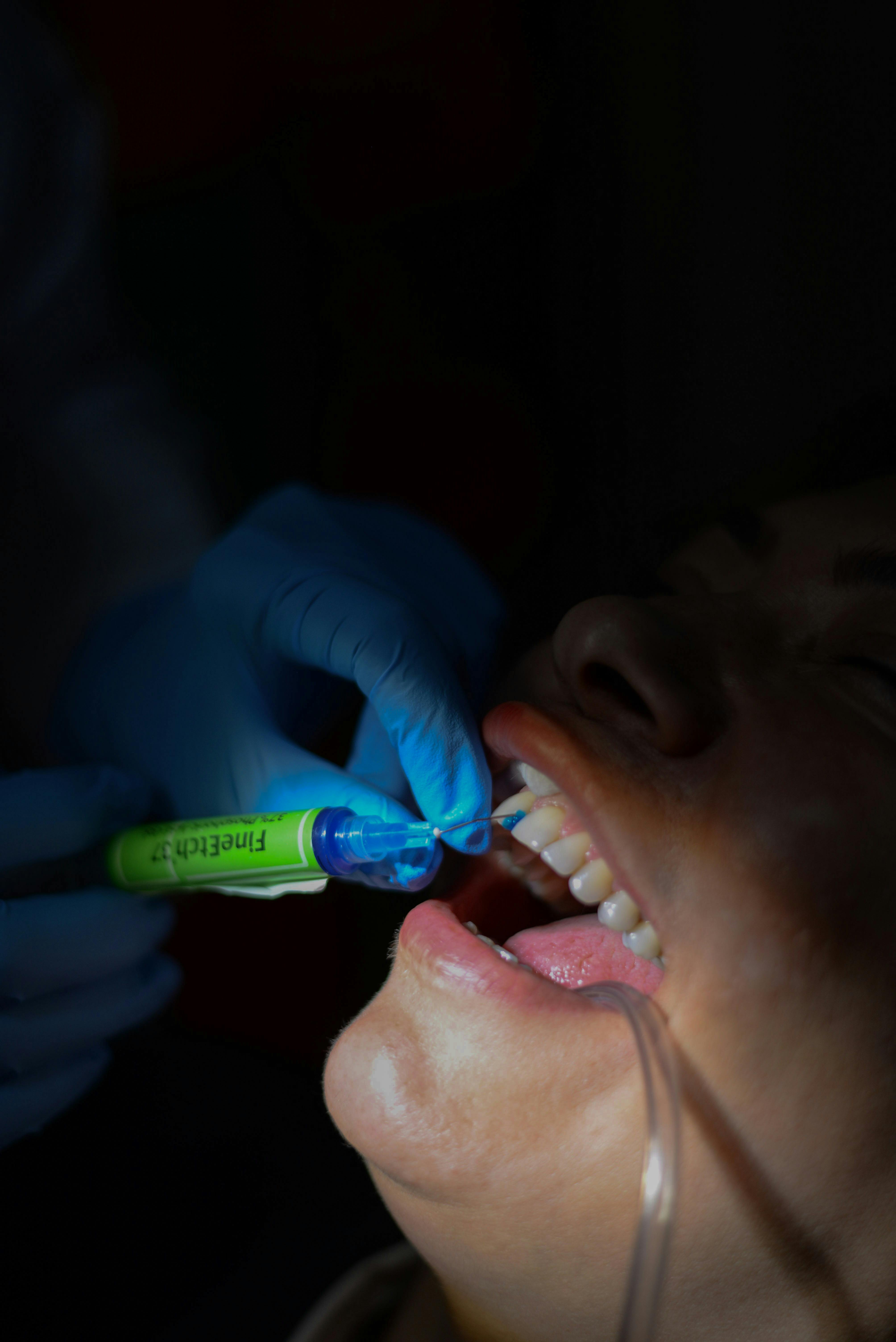 Dental Aesthetics